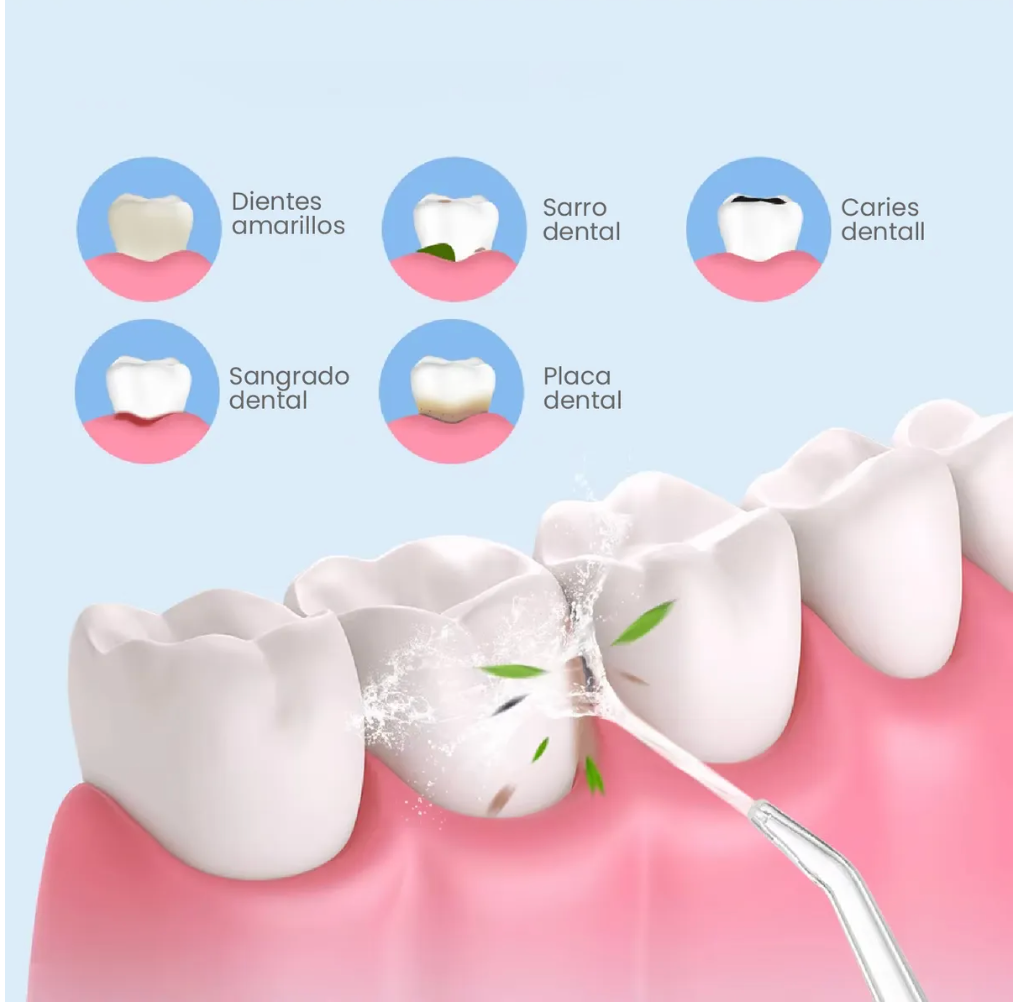 🧺 Irrigador Bucal electrico