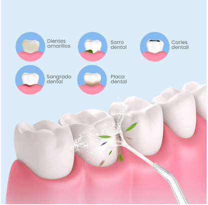 🧺 Irrigador Bucal electrico